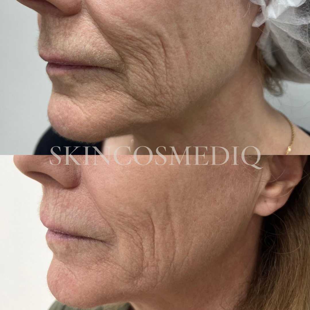 B&A2