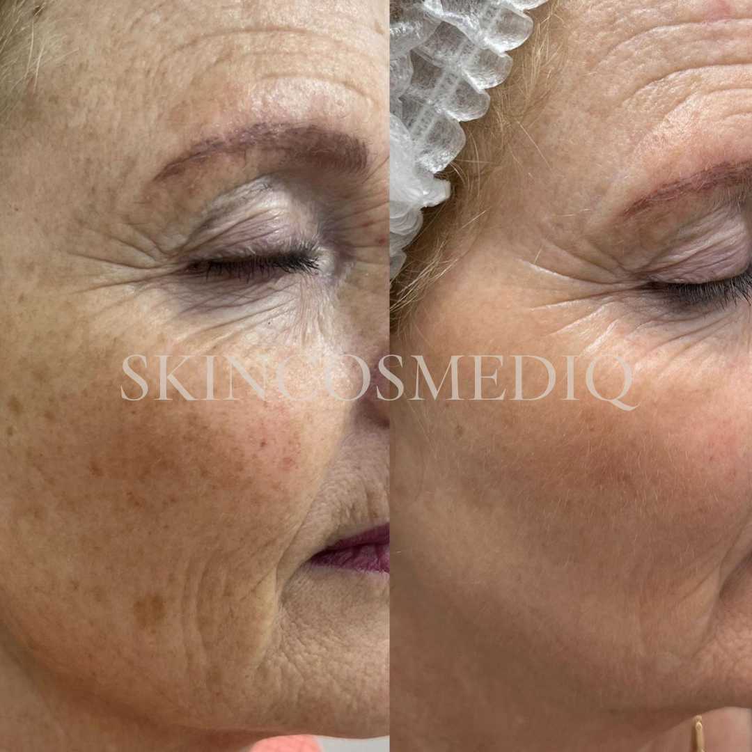 B&A4